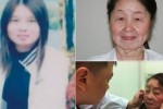 ၂၈ ႏွစ္အရြယ္ တ႐ုတ္အမ်ိဳးသမီး တစ္ဦး ထူးဆန္းေသာေရာဂါေၾကာင့္ အသက္ ၈၀ အရြယ္ အဖြားအုိပံုျဖစ္သြားခဲ့