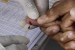 ဆယ္ေက်ာ္သက္မ်ား AIDS ေရာဂါေၾကာင့္ ေသဆုံးသူ ၅ ႏွစ္အတြင္း သုံးဆျဖစ္လာ